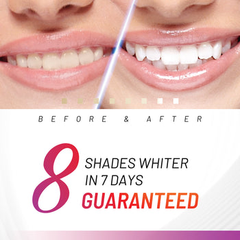 Accelerator Teeth Whitening Kit
